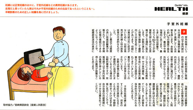 子宮外妊娠
